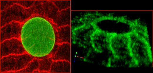 חלבון ה-300-MSP, הנראה כאן תחת מיקרוסקופ קונפוקלי, סובב את גרעין תא השריר (מימין: בירוק; משמאל: באדום) עם שלוחות לשלד התא